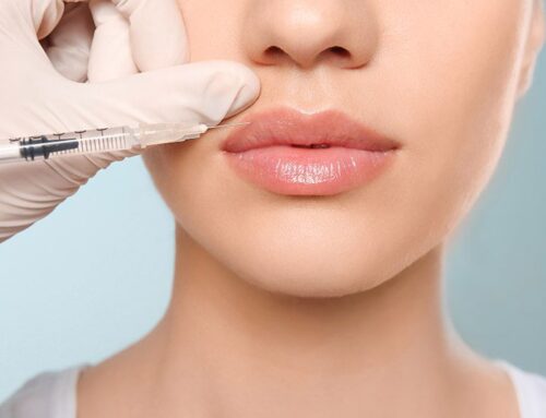 Knowing the Types, Benefits, and Side Effects of Dermal Fillers